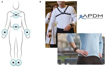 Quantitative Evaluation of Gait Changes Using APDM Inertial Sensors After the External Lumbar Drain in Patients With Idiopathic Normal Pressure Hydrocephalus